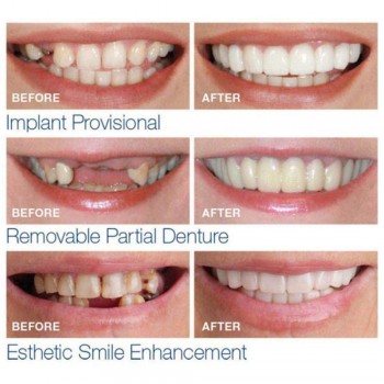 Natural Cosmetic Fake Tooth Cover Funny Toys Snap On Silicone Perfect Smile Veneers Teeth Beauty Tool Teeth Gift for Men Women